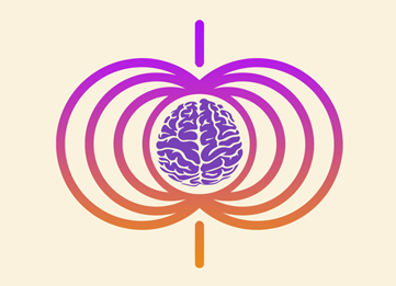 Estimulación Magnética Transcraneal